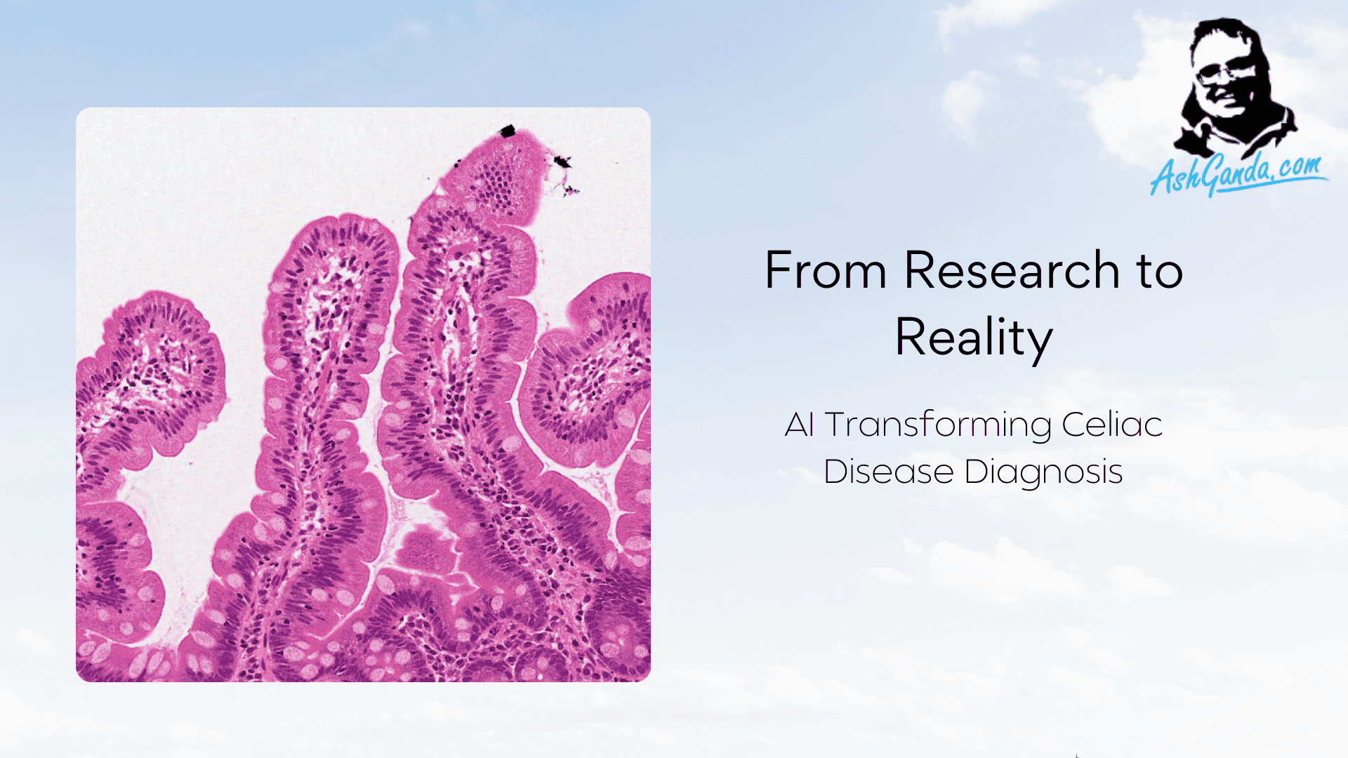 AI for Celiac Disease Diagnosis: From Research to Reality